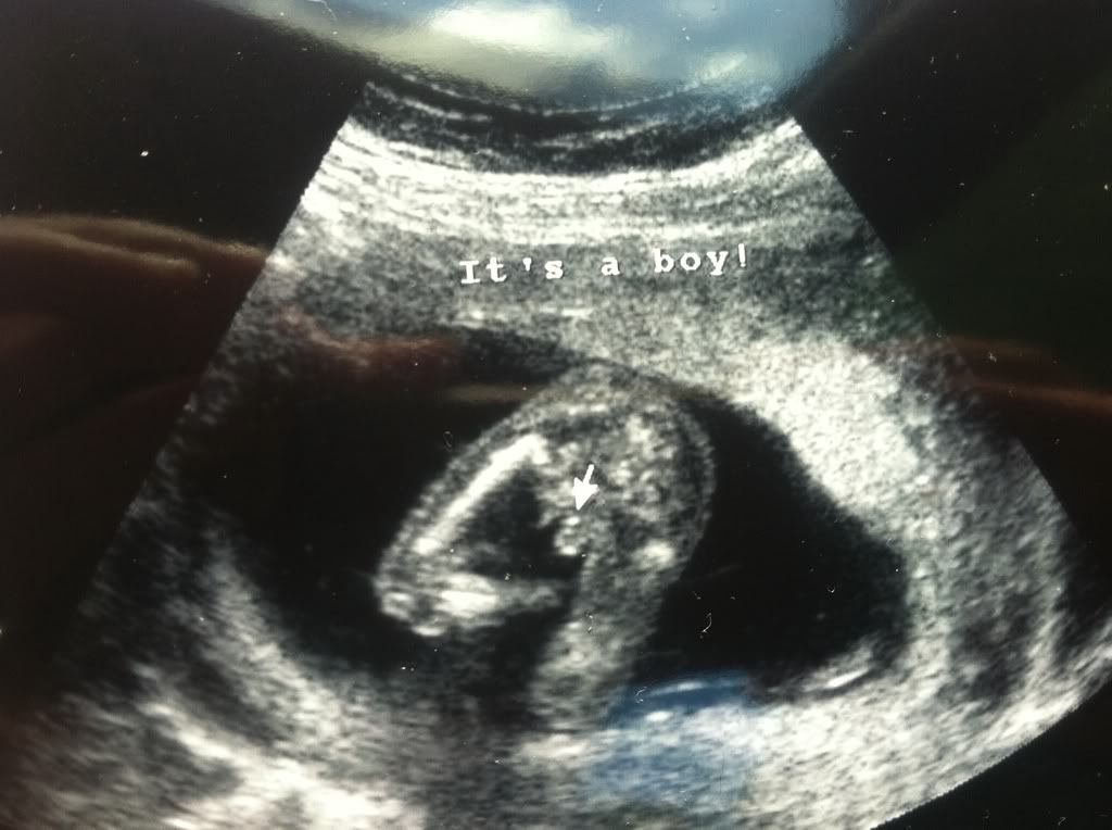 Potty Shot At 16 Weeks! HELP! in Ultrasound Gender Prediction (2011